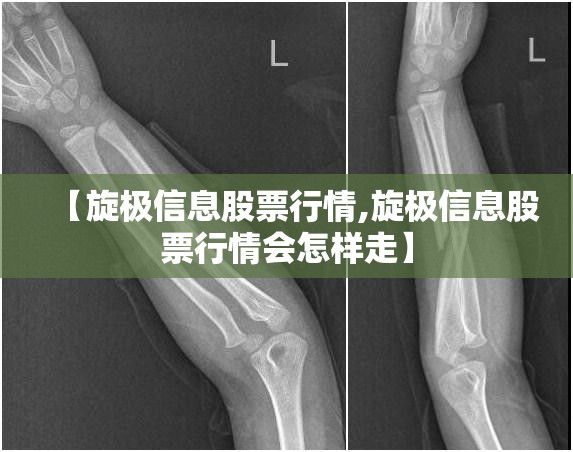 【旋极信息股票行情,旋极信息股票行情会怎样走】 【旋极信息股票行情,旋极信息股票行情会怎样走】
