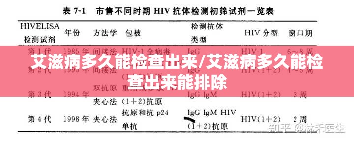 艾滋病多久能检查出来/艾滋病多久能检查出来能排除